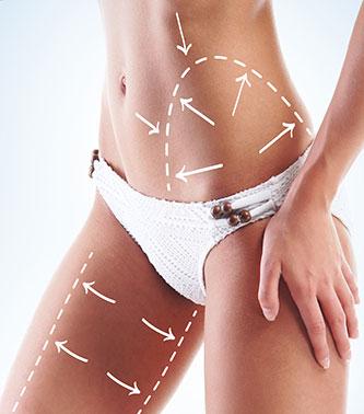 medical tourism mommy makeover mermaid lift